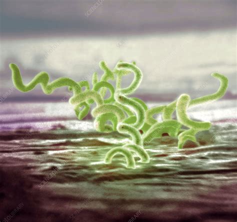 Bacteria Treponema Pallidum Sem Stock Image C0129725 Science