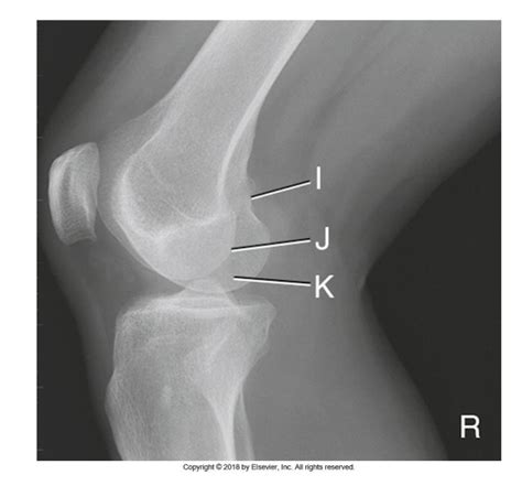 Lateral Knee X Rays