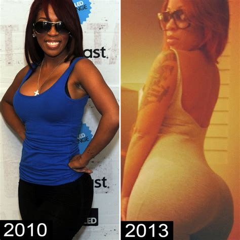 Before And After Pics Of Celebrities With Rumored Butt Implants