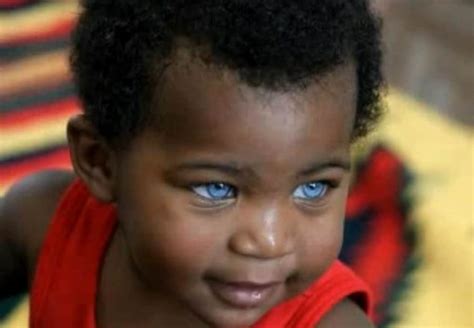 Black Africans With Blue Eyes The Truth About It All To Know