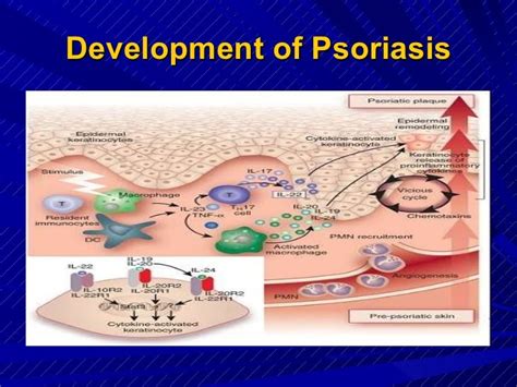 Il17 Andstat 3 In Psoriasis Pathogenesis
