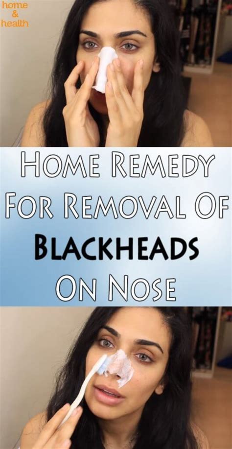 This Remedy Will Eliminate Blackheads And The Good News Is That It Is