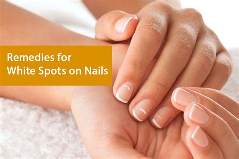 White Spots On Nails Causes And Remedies How To Cure