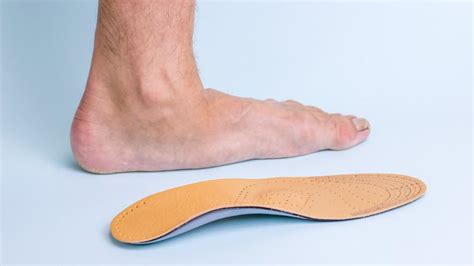 Complications Of Flat Feet Allcare Foot And Ankle Center Podiatry