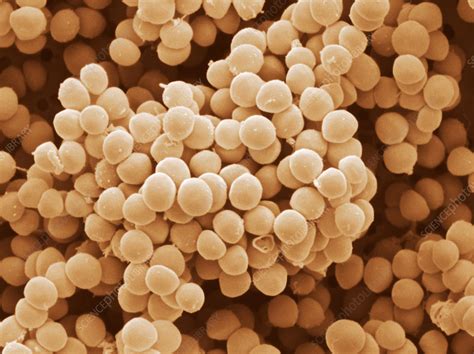 Staphylococcus Saprophyticus Stock Image B2340182 Science Photo