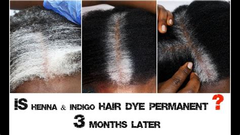 White Or Grey Hair Into Black Naturally 3 Months Later Is