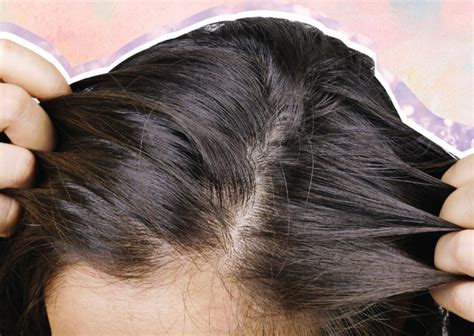 Signs Your Scalp Is Craving Some Tlc And What To Do About It Blog