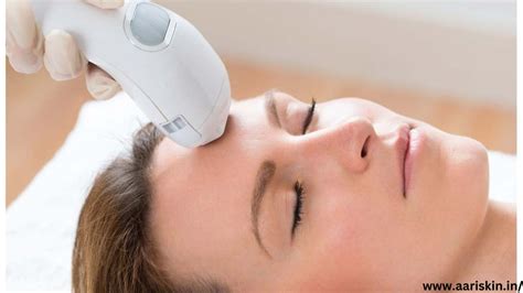 6 Incredible Benefits Of A Photofacial How It Works And Benefits