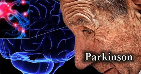 Fisioterapia Entenda A Diferença Entre Parkinson E Parkinsonismo