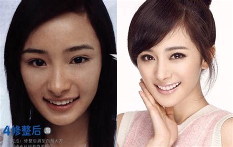 Plastic Surgery Yang Mis Nose And Jaw Refinement