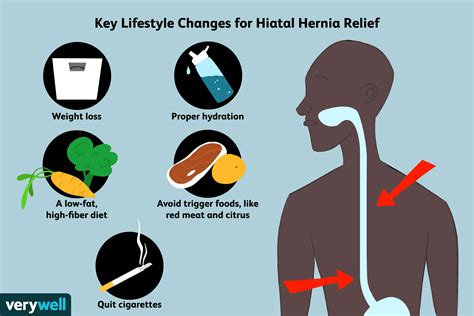 How A Hiatal Hernia Is Treated