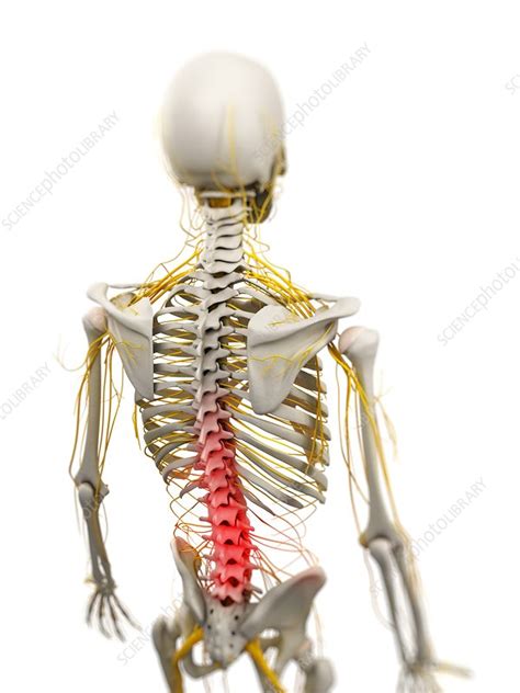 Back Pain Conceptual Artwork Stock Image F0041249 Science Photo