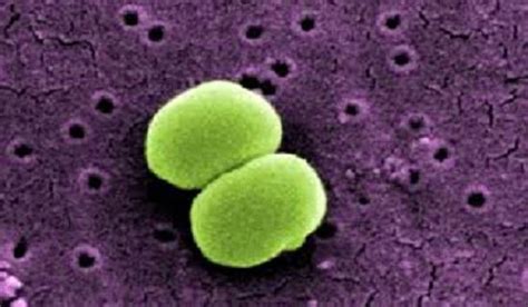Staphylococcus Epidermidis Caracteristicas Morfologia Lifeder Images