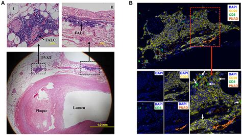 Frontiers Perivascular Adipose Tissue Harbors Atheroprotective Igm