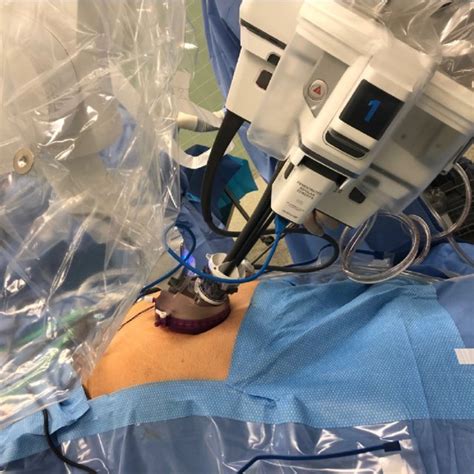 Pdf Single Port Robotic Surgery The Next Generation Of Minimally Invasive Urology
