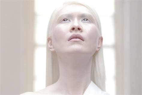 Worlds First Albino Model Connie Chiu On Growing Up In Kowloon And