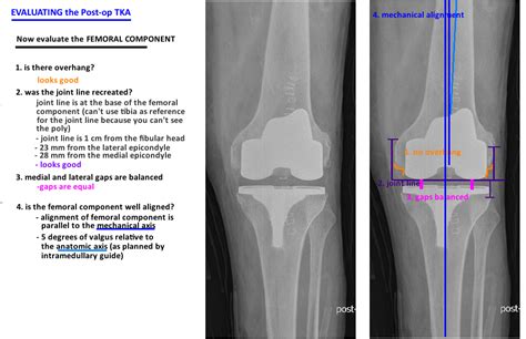 Post Op Evaluation — Hip And Knee Book