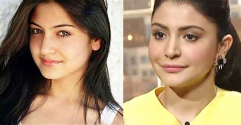 Check Out How Plastic Surgery Transformed These Actresses