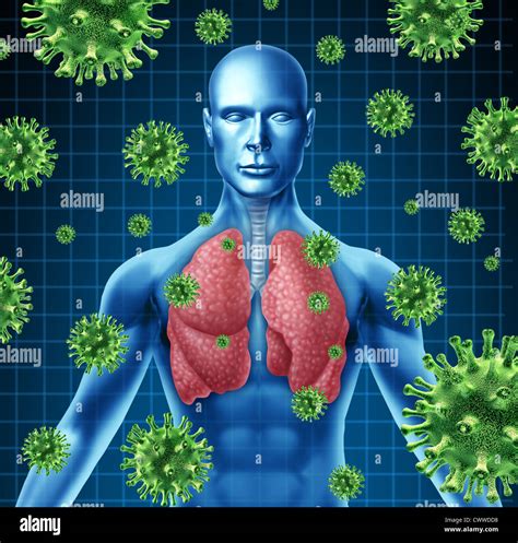 Infecci N Pulmonar Representada Por Un Humano Con La Imagen De Rayos X De Los Pulmones Y El