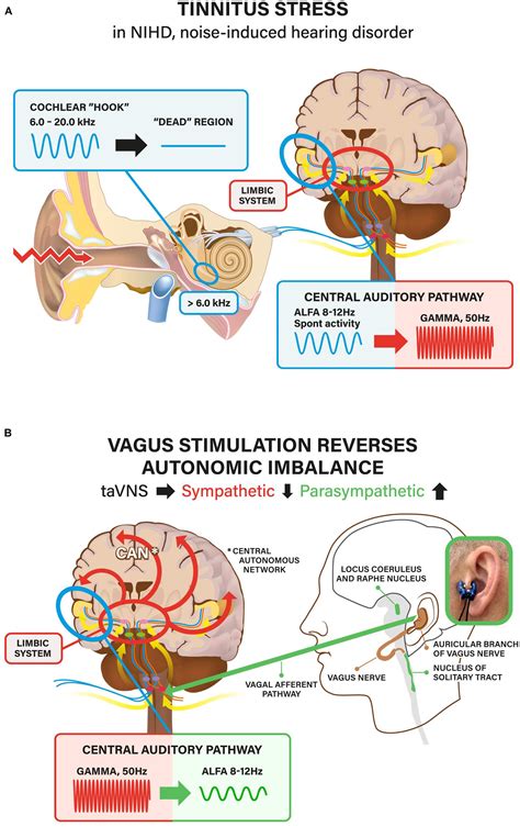 Frontiers Stress And Tinnitus Transcutaneous Auricular Vagal Nerve