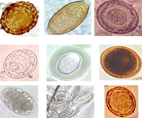 Human Parasites Under The Microscope