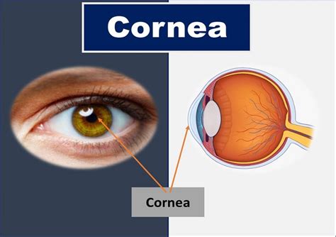 Cornea Rotary Eye Hospital