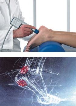 Advanced Regenerative Medicine Shockwave Therapy Foot Ankle