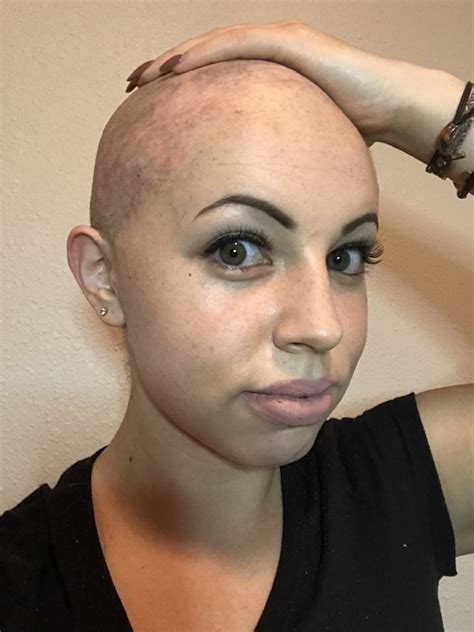 Why I Shaved My Head — Dorin Azérad