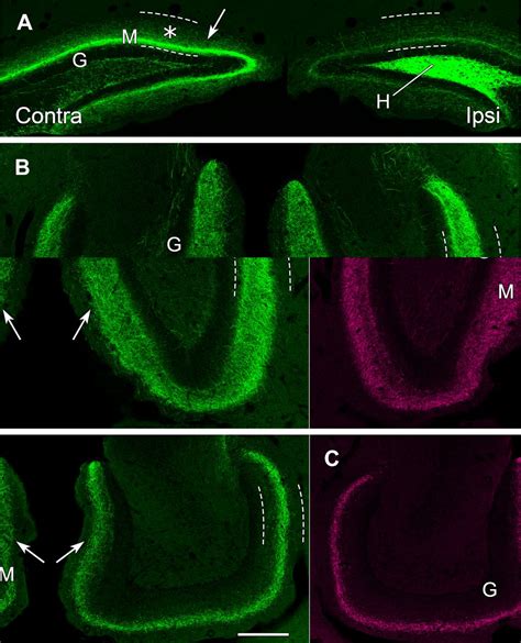 Mossy Cells In The Dorsal And Ventral Dentate Gyrus Differ In Their