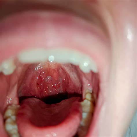 Накачаться возможно ли