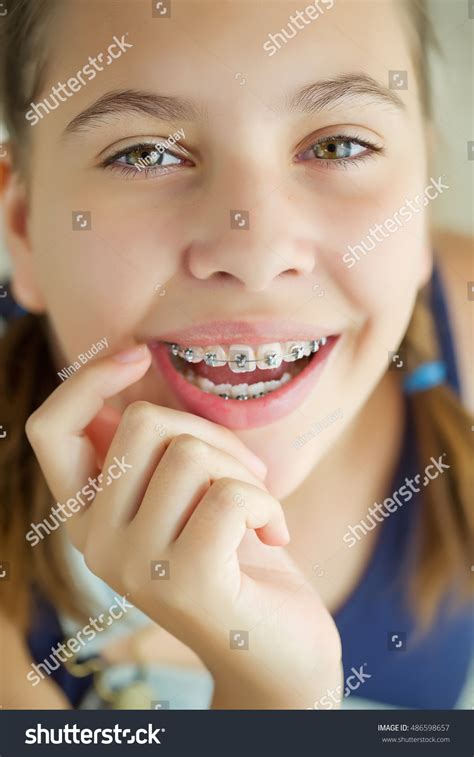 Portrait Of Teen Girl Showing Dental Braces Stock Photo 486598657