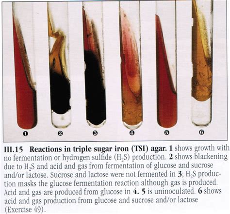 Triple Sugar Iron Agar Biochemical Tests Microbiology