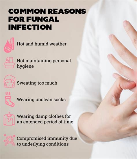 Best 9 Home Remedies For Fungal Infection That Will Give You Relief 2023