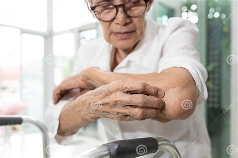 Old Elderly Scratching Arm Elbow Itchy Skinskin Irritationatopic