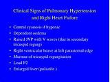 Clinical Signs Of Pulmonary Hypertension Images