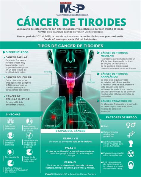 Cancer Ca De Tiroides Infografía By Msp Med Tac International Corp