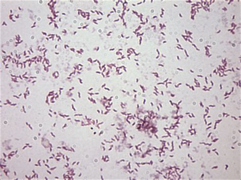 Campylobacter Causes Symptoms Treatment Campylobacter