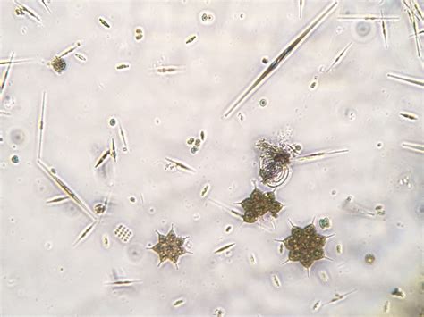 Just Some Pondwater Algae Under The Microscope