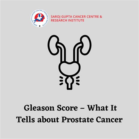 Gleason Score What It Tells About Prostate Cancer