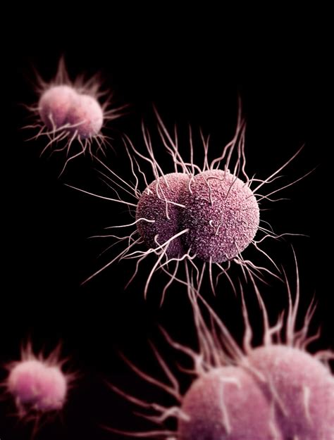 Gonorrhea May Soon Be Untreatable Britains Chief Medical Officer