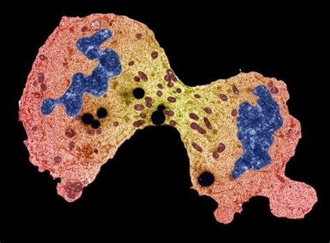 Cancer is not a month so it doesn't have a birthstone. Sarcoma Awareness Month | Center for Cancer Research ...
