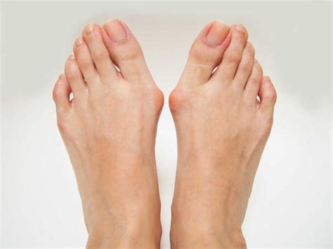 Exercise Tips For Arthritic Feet And Ankles Washington Foot Ankle Sports Medicine Podiatry