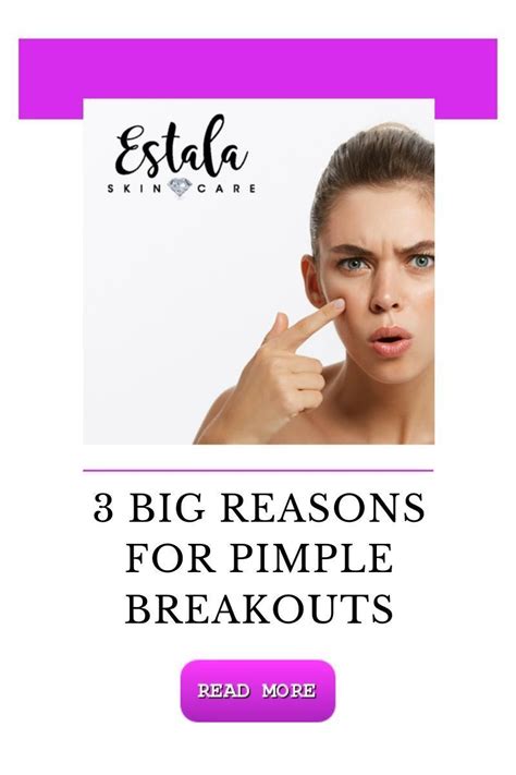 3 Big Reasons For Pimple Breakouts Are You Wondering Why You Still