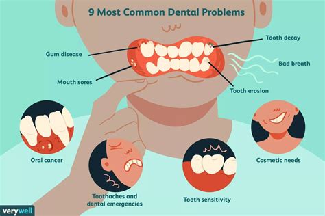 What Are The Most Common Dental Problems Https Verywellhealth Com Top Common Dental