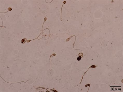 Tunel Staining Brown Stained Sperm Shows Apoptosis Light Colored Download Scientific Diagram