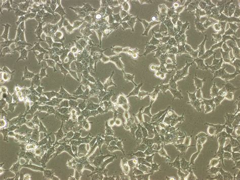 The vero cells can be applied to vaccine production ranges from live rotavirus vaccines to live attenuated influenza vaccines to the development of inactivated whole virus vaccines. What could be causing cytoplasmic granules in VERO cells ...