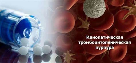 Диета при идиопатической тромбоцитопенической пурпуре Стандарт медпомощи взрослым при идиопатической тромбоцитопенической пурпуре Стандарт медпомощи взрослым при идиопатической тромбоцитопенической пурпуре Диета при идиопатической тромбоцитопенической пурпуре