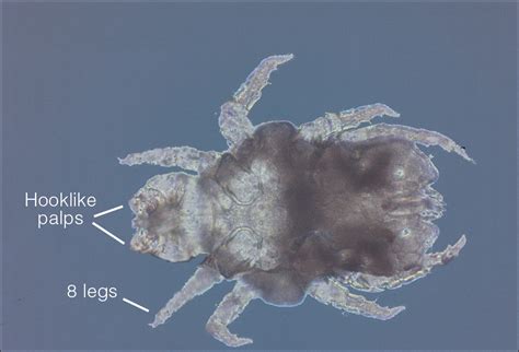 Whats Eating You Cheyletiella Mites Mdedge Dermatology