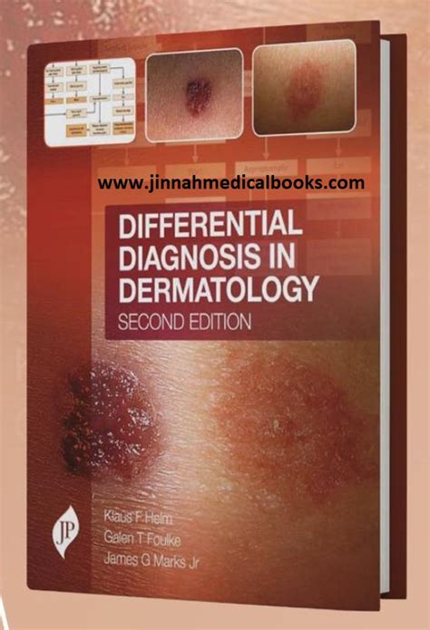 Differential Diagnosis In Dermatology All Dermatology Books Available