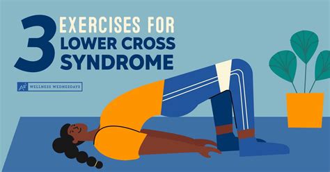 Effective Lower Cross Syndrome Exercises For Better Posture Learn All About Yoga
